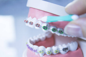 dentures dentists